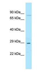 SOST / Sclerostin Antibody - SOST / Sclerostin antibody Western Blot of MCF7 whole cell lysate.  This image was taken for the unconjugated form of this product. Other forms have not been tested.