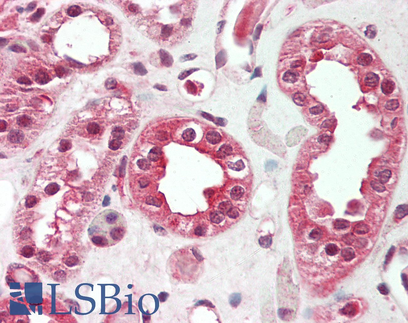 SOST / Sclerostin Antibody - Human Kidney: Formalin-Fixed, Paraffin-Embedded (FFPE).  This image was taken for the unconjugated form of this product. Other forms have not been tested.