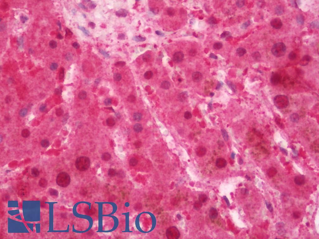 SOX4 Antibody - Human Liver: Formalin-Fixed, Paraffin-Embedded (FFPE)