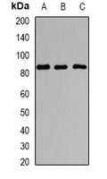 SOX5 Antibody - Western blot analysis of Sox-5 expression in HepG2 (A); SHSY5Y (B); mouse heart (C) whole cell lysates.