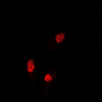 SOX5 Antibody - Immunofluorescent analysis of Sox-5 staining in U2OS cells. Formalin-fixed cells were permeabilized with 0.1% Triton X-100 in TBS for 5-10 minutes and blocked with 3% BSA-PBS for 30 minutes at room temperature. Cells were probed with the primary antibody in 3% BSA-PBS and incubated overnight at 4 deg C in a humidified chamber. Cells were washed with PBST and incubated with a DyLight 594-conjugated secondary antibody (red) in PBS at room temperature in the dark.