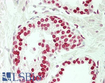 SOX5 Antibody - Human Prostate: Formalin-Fixed, Paraffin-Embedded (FFPE)