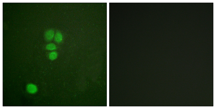 SOX9 Antibody - Immunofluorescence analysis of A549 cells, using SOX9 Antibody. The picture on the right is blocked with the synthesized peptide.