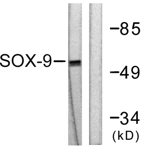 SOX9 Antibody - Western blot analysis of lysates from 293 cells, treated with PBS 60', using SOX9 Antibody. The lane on the right is blocked with the synthesized peptide.