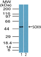 SOX9 Antibody - Western blot of SOX9 in mouse embryo brain lysate in the 1) absence and 2) presence of immunizing peptide using Polyclonal Antibody to SOX9 at 2 ug/ml. Goat anti-rabbit Ig HRP secondary antibody, and PicoTect ECL substrate solution, were used for this test.