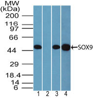 SOX9 Antibody - Western blot of SOX9 in human brain lysate in the 1) absence and 2) presence of immunizing peptide, 3) mouse brain and 4) rat brain lysate using Polyclonal Antibody to SOX9 at 3 ug/ml.