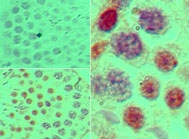 SOX9 Antibody - IHC of SOX9 in formalin-fixed, paraffin-embedded mouse testis tissue using an isotype control (top left) and Polyclonal Antibody to SOX9 (bottom left, right) at 5 ug/ml.