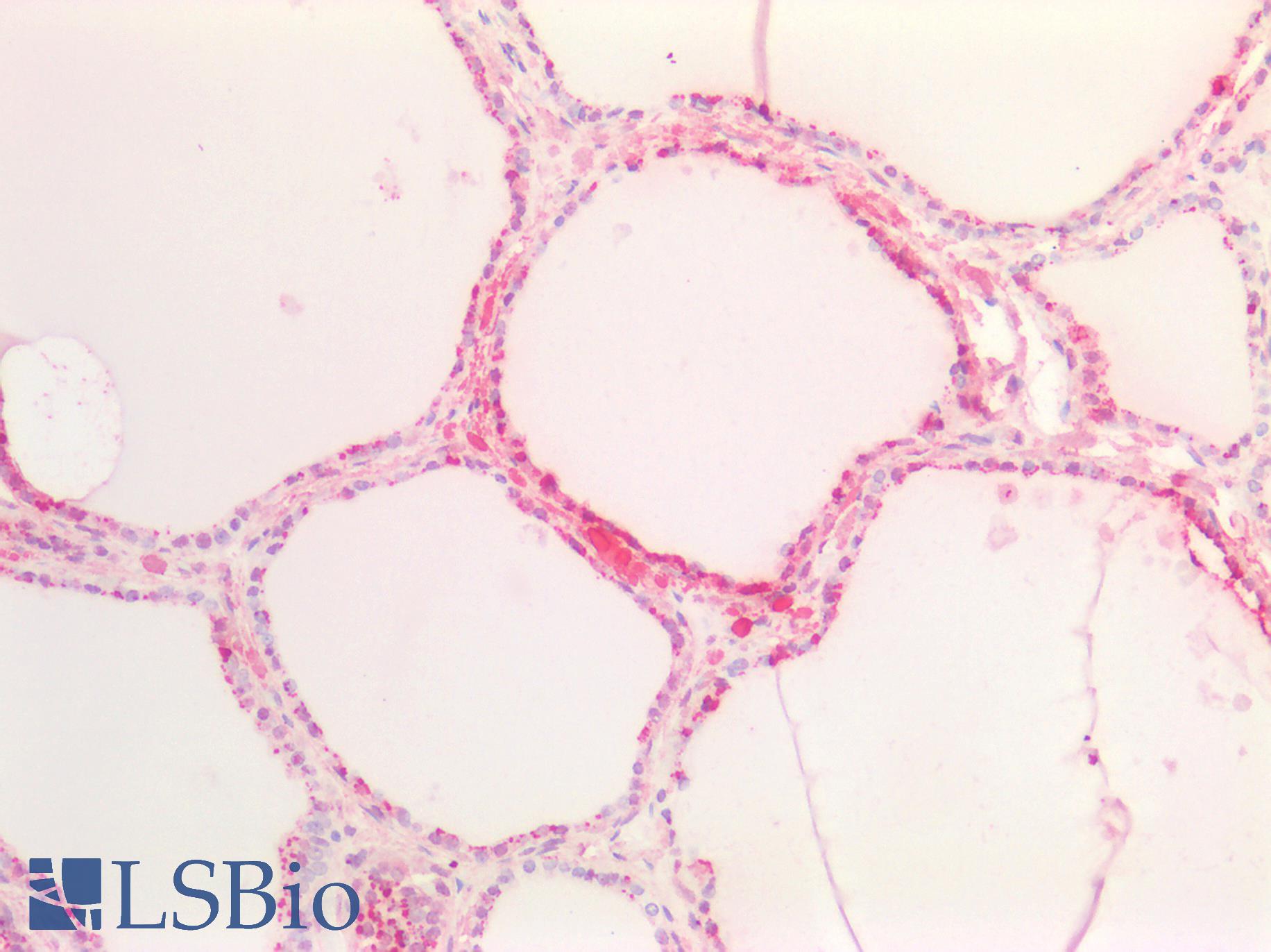 SOX9 Antibody - Human Thyroid: Formalin-Fixed, Paraffin-Embedded (FFPE)