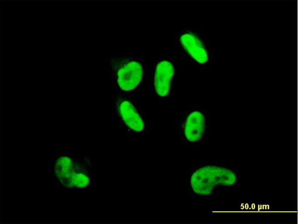SOX9 Antibody - Immunofluorescence of monoclonal antibody to SOX9 on HepG2 cell (antibody concentration 10 ug/ml).