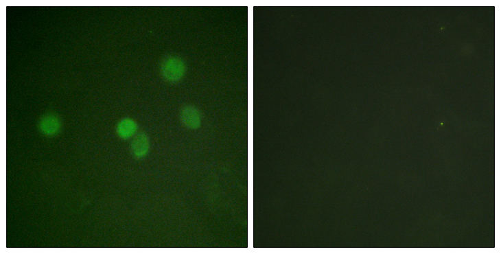 SP1 Antibody - Immunofluorescence analysis of A549 cells, using SP1 Antibody. The picture on the right is blocked with the synthesized peptide.