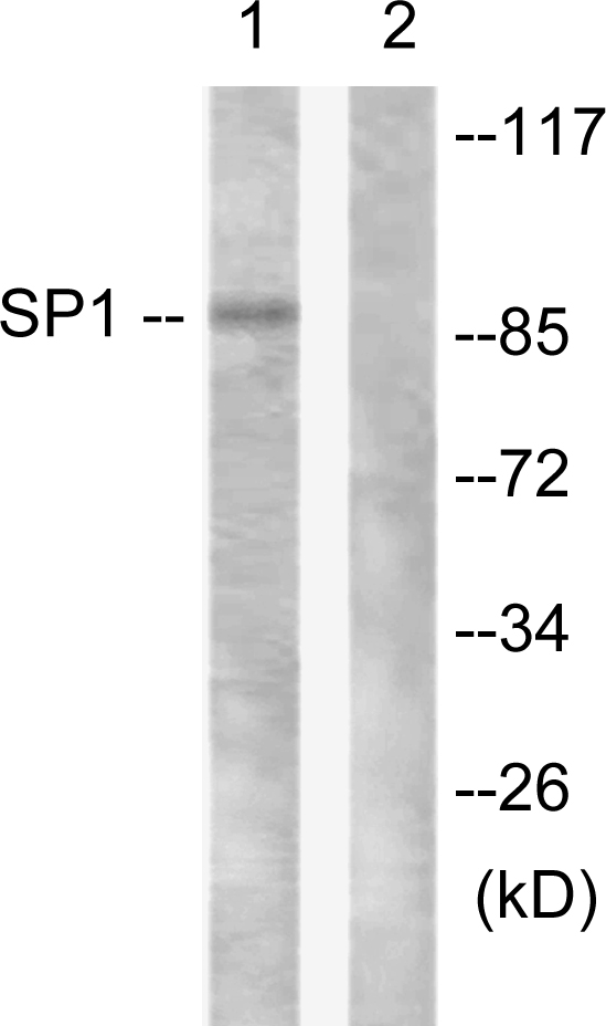 SP1 Antibody - Western blot analysis of lysates from LOVO cells, using SP1 Antibody. The lane on the right is blocked with the synthesized peptide.