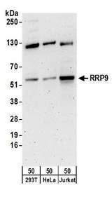 SP1 Antibody - Detection of human RRP9 by western blot. Samples: Whole cell lysate (50 µg) from HEK293T, HeLa, and Jurkat cells. Antibodies: Affinity purified rabbit anti-RRP9 antibody used for WB at 0.4 µg/ml. Detection: Chemiluminescence with an exposure time of 3 minutes.