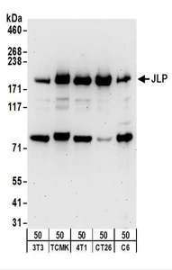 SPAG9 Antibody - Detection of Mouse and Rat JLP by Western Blot. Samples: Whole cell lysate (50 ug) from NIH3T3, TCMK-1, 4T1, CT26.WT, and rat C6 cells. Antibodies: Affinity purified rabbit anti-JLP antibody used for WB at 1 ug/ml. Detection: Chemiluminescence with an exposure time of 3 minutes.