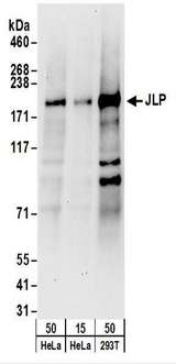 SPAG9 Antibody - Detection of Human JLP by Western Blot. Samples: Whole cell lysate from HeLa (15 and 50 ug) and 293T (50 ug) cells. Antibodies: Affinity purified rabbit anti-JLP antibody used for WB at 0.1 ug/ml. Detection: Chemiluminescence with an exposure time of 30 seconds.