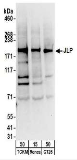 SPAG9 Antibody - Detection of Mouse JLP by Western Blot. Samples: Whole cell lysate from TCKM (50 ug), Renca (50 ug), and CT26 (50 ug) cells. Antibodies: Affinity purified rabbit anti-JLP antibody used for WB at 0.1 ug/ml. Detection: Chemiluminescence with an exposure time of 10 seconds.
