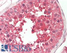 SPAG9 Antibody - Anti-SPAG9 antibody IHC staining of human testis. Immunohistochemistry of formalin-fixed, paraffin-embedded tissue after heat-induced antigen retrieval. Antibody concentration 5 ug/ml.
