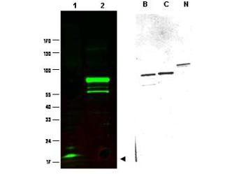 SPANXC / SPANX-C Antibody - Anti-SPANX-C Antibody - Western Blot. Western blot of Protein A purified anti-SPANX-C antibody shows detection of a band at ~17 kD corresponding to SPANX-C present in a nuclear extract from VWM105 cells (left panel, arrowhead). VWM105 cells are derived from a human melanoma and are positive for SPANX proteins. Lane 2 shows reactivity with a purified recombinant SPANX-C fusion protein. The right panel shows similar reactivity with purified recombinant SPANX-B, SPANX-C and SPANX-N proteins. Proteins were separated by SDS-PAGE, transferred to nitrocellulose, and probed with the primary antibody diluted to 1:1000. IRDye800 conjugated Gt-a-Rabbit IgG [H&L] MX ( was used (left). IRDye is a trademark of LI-COR, Inc. Size estimation was made by comparison to prestained MW markers as indicated. Personal Communication. Vladimir Larionov, NIH, CCR, Bethesda, MD.
