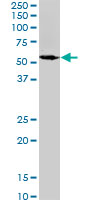 Spastin Antibody - SPAST monoclonal antibody (M02), clone 2F5. Western blot of SPAST expression in Jurkat.