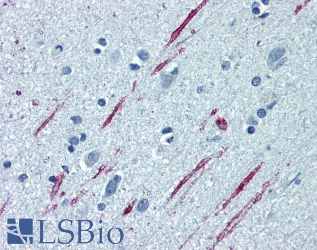 Spastin Antibody - Anti-SPAST / Spastin antibody IHC of human brain, cortex. Immunohistochemistry of formalin-fixed, paraffin-embedded tissue after heat-induced antigen retrieval. Antibody concentration 5 ug/ml.