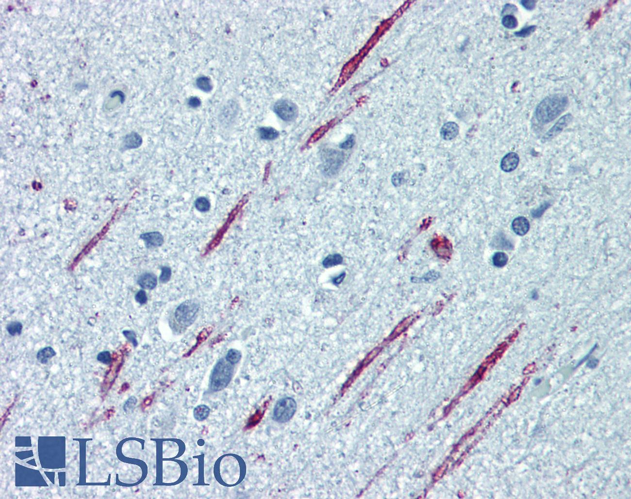 Spastin Antibody - Anti-SPAST / Spastin antibody IHC of human brain, cortex. Immunohistochemistry of formalin-fixed, paraffin-embedded tissue after heat-induced antigen retrieval. Antibody concentration 5 ug/ml.