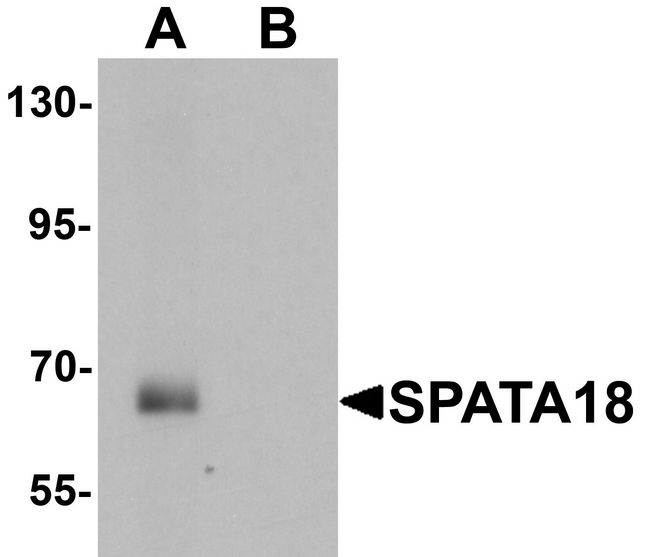 SPATA18 / MIEAP Antibody - Western blot analysis of SPATA18 in rat lung tissue lysate with SPATA18 antibody at 1 ug/ml in (A) the absence and (B) the presence of blocking peptide