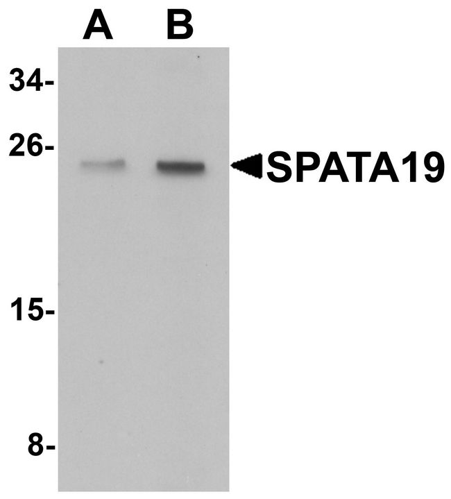 SPATA19 Antibody - Western blot analysis of SPATA19 in rat lung tissue lysate with SPATA19 antibody at (A) 1 and (B) 2 ug/ml.