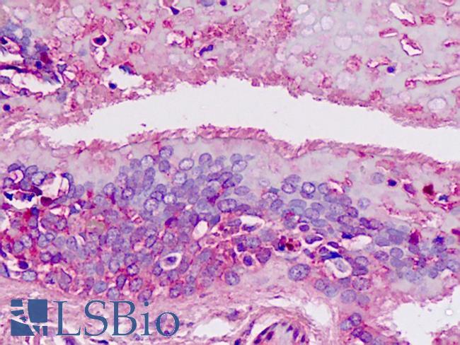 SPC18 / SEC11A Antibody - Anti-SPC18 / SEC11A antibody IHC staining of human lung. Immunohistochemistry of formalin-fixed, paraffin-embedded tissue after heat-induced antigen retrieval.