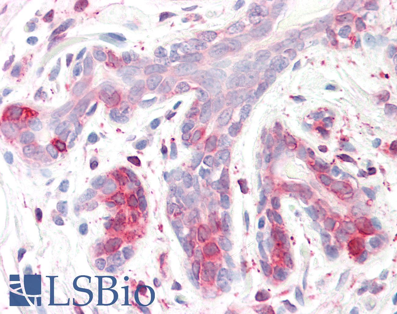 SPFH2 / ERLIN2 Antibody - Anti-SPFH2 / ERLIN2 antibody IHC staining of human breast. Immunohistochemistry of formalin-fixed, paraffin-embedded tissue after heat-induced antigen retrieval.