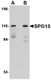 SPG15 / ZFYVE26 Antibody - Western blot of SPG15 in rat heart tissue lysate with SPG15 antibody at (A) 0.5 and (B) 1 ug/ml.
