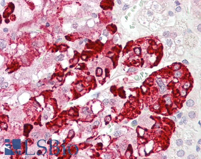 SPHKAP Antibody - Anti-SPHKAP antibody IHC staining of human adrenal. Immunohistochemistry of formalin-fixed, paraffin-embedded tissue after heat-induced antigen retrieval.