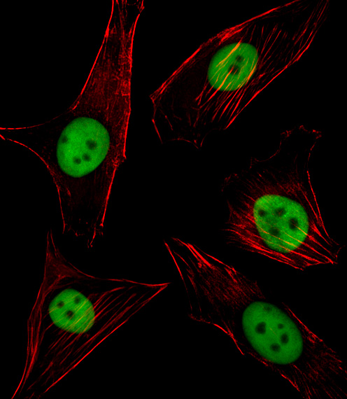 SPI1 / PU.1 Antibody - Fluorescent image of NIH/3T3 cell stained with SPI1 Antibody. NIH/3T3 cells were fixed with 4% PFA (20 min), permeabilized with Triton X-100 (0.1%, 10 min), then incubated with SPI1 primary antibody (1:25, 1 h at 37°C). For secondary antibody, Alexa Fluor 488 conjugated donkey anti-rabbit antibody (green) was used (1:400, 50 min at 37°C). Cytoplasmic actin was counterstained with Alexa Fluor 555 (red) conjugated Phalloidin (7units/ml, 1 h at 37°C). SPI1 immunoreactivity is localized to Nucleus significantly.