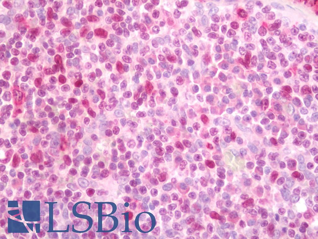 SPI1 / PU.1 Antibody - Human Tonsil: Formalin-Fixed, Paraffin-Embedded (FFPE).  This image was taken for the unconjugated form of this product. Other forms have not been tested.