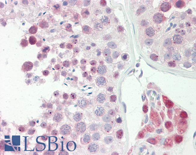 SPIN / SPIN1 Antibody - Anti-SPIN / SPIN1 antibody IHC staining of human testis. Immunohistochemistry of formalin-fixed, paraffin-embedded tissue after heat-induced antigen retrieval. Antibody dilution 1:100.