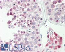 SPIN / SPIN1 Antibody - Anti-SPIN / SPIN1 antibody IHC staining of human testis. Immunohistochemistry of formalin-fixed, paraffin-embedded tissue after heat-induced antigen retrieval. Antibody dilution 1:100.