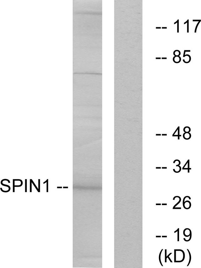 SPIN / SPIN1 Antibody - Western blot analysis of lysates from HeLa cells, using SPIN1 Antibody. The lane on the right is blocked with the synthesized peptide.