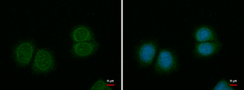 SPINK1 Antibody - SPINK1 antibody detects SPINK1 protein at cytoplasm by immunofluorescent analysis.Sample: MCF-7 cells were fixed in ice-cold MeOH for 5 min.Green: SPINK1 protein stained by Anti-SPINK1 antibody diluted at 1:500.Blue: Hoechst 33342 staining.