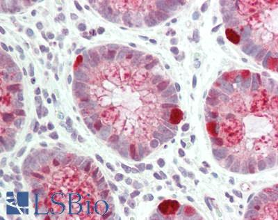 SPINK1 Antibody - Human Colon: Formalin-Fixed, Paraffin-Embedded (FFPE)
