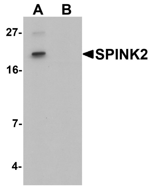SPINK2 Antibody - Western blot analysis of SPINK2 in mouse heart tissue lysate with SPINK2 antibody at 1 ug/ml in (A) the absence and (B) the presence of blocking peptide.