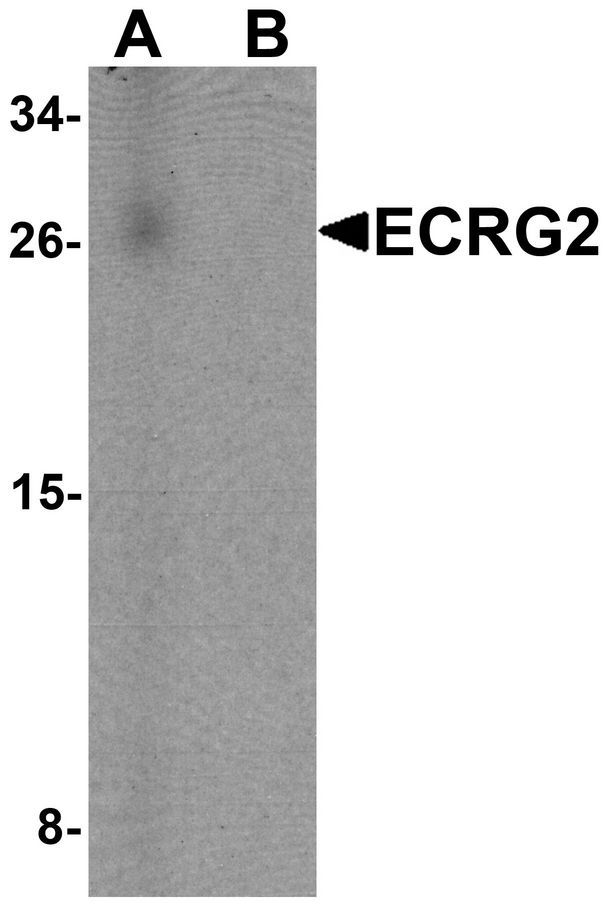 SPINK7 / ECRG2 Antibody - Western blot analysis of ECRG2 in human lung tissue lysate with ECRG2 antibody at 1 ug/ml in (A) the absence and (B) the presence of blocking peptide.