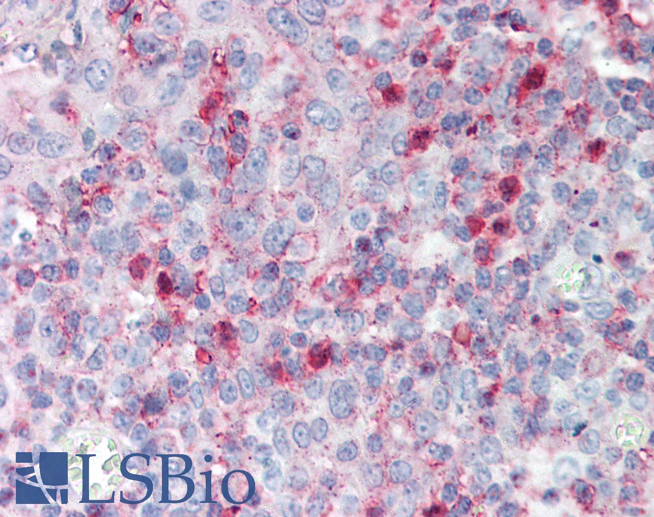 SPON2 / MINDIN Antibody - Anti-SPON2 / MINDIN antibody IHC staining of human tonsil. Immunohistochemistry of formalin-fixed, paraffin-embedded tissue after heat-induced antigen retrieval. Antibody concentration 5 ug/ml.