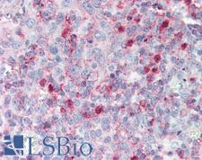 SPON2 / MINDIN Antibody - Anti-SPON2 / MINDIN antibody IHC staining of human tonsil. Immunohistochemistry of formalin-fixed, paraffin-embedded tissue after heat-induced antigen retrieval. Antibody concentration 5 ug/ml.