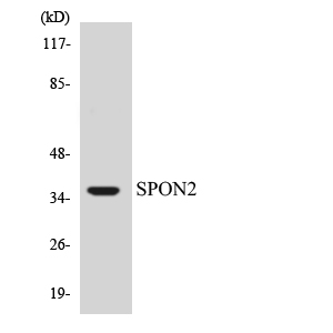 SPON2 / MINDIN Antibody - Western blot analysis of the lysates from HUVECcells using SPON2 antibody.