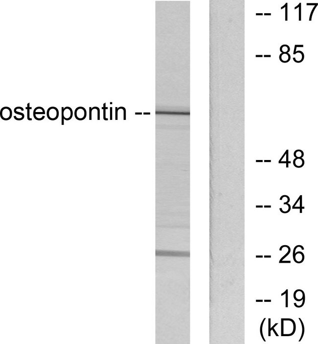 SPP1 / Osteopontin Antibody - Western blot analysis of lysates from LOVO cells, using Osteopontin Antibody. The lane on the right is blocked with the synthesized peptide.