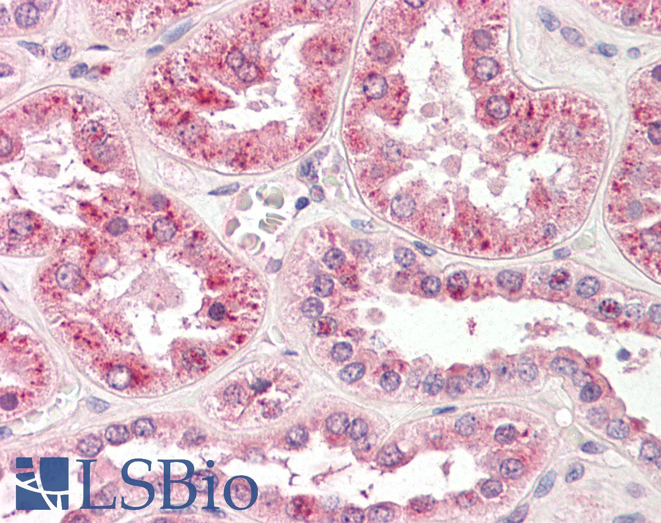 SPP1 / Osteopontin Antibody - Anti-Hemopexin antibody IHC of human kidney. Immunohistochemistry of formalin-fixed, paraffin-embedded tissue after heat-induced antigen retrieval. Antibody dilution 1:50.  This image was taken for the unconjugated form of this product. Other forms have not been tested.