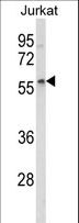 SPRED1 Antibody - Western blot of SPRED1 Antibody in Jurkat cell line lysates (35 ug/lane). SPRED1 (arrow) was detected using the purified antibody.