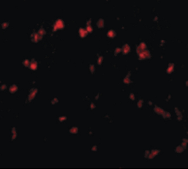 SPRED1 Antibody - Immunofluorescence of Spred1 in Human Brain cells with Spred1 antibody at 20 ug/ml.