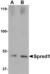 SPRED1 Antibody - Western blot of Spred1 in human brain tissue lysate with Spred1 antibody at (A) 1 and (B) 2 ug/ml.
