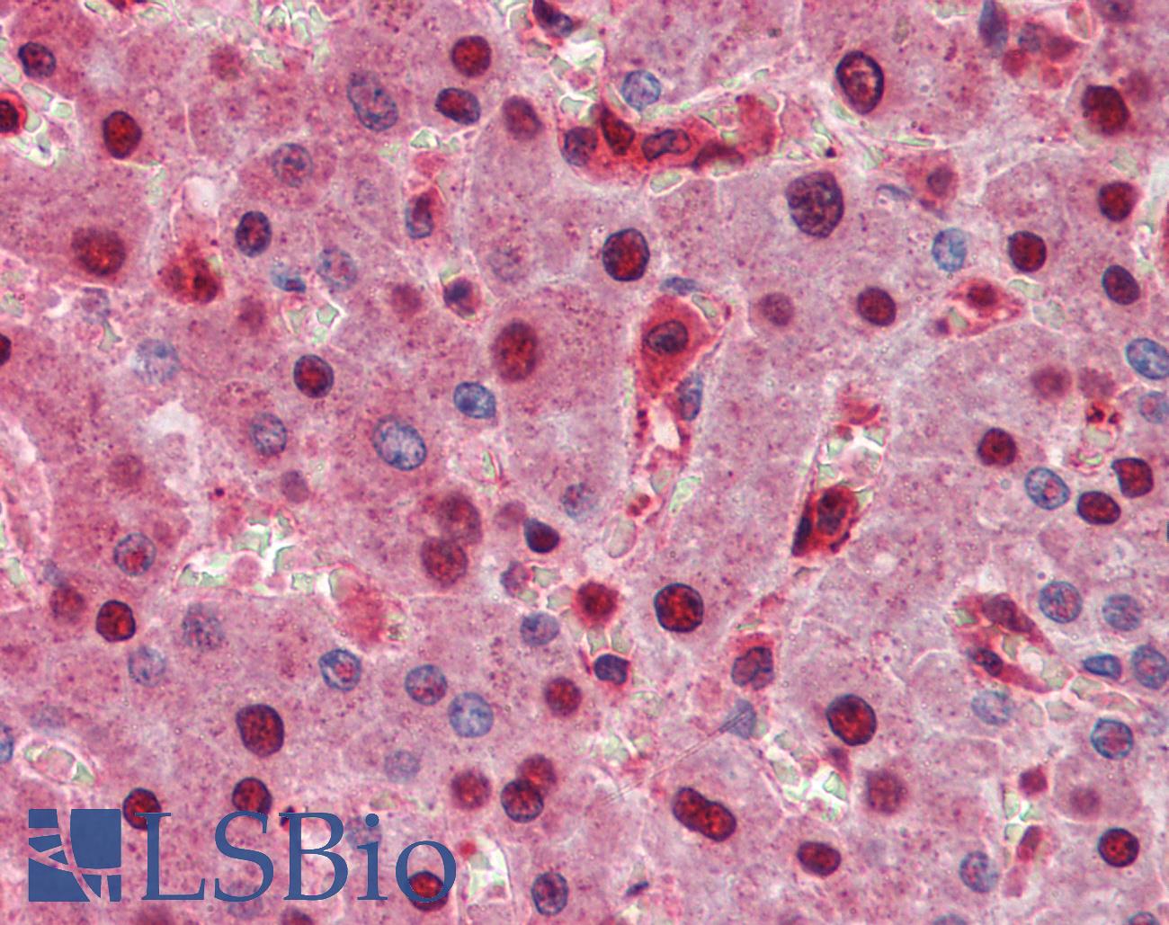 SPRED1 Antibody - Anti-SPRED1 antibody IHC of human liver. Immunohistochemistry of formalin-fixed, paraffin-embedded tissue after heat-induced antigen retrieval. Antibody concentration 5 ug/ml.