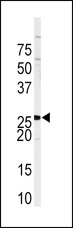 Sprouty 4 / SPRY4 Antibody - Western blot of anti-SPRY4 Antibody in Sk-Br-3 cell line lysates (35 ug/lane). SPRY4 (arrow) was detected using the purified antibody.