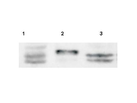 Sprouty 4 / SPRY4 Antibody - Anti-Sprouty-4 Antibody - Western Blot. Western blot of Affinity Purified anti-Sprouty-4 antibody shows detection of a doublet band ~35 kD corresponding to human Sprouty-4. Approximately 30 ug of HeLa (lane 1), SW13 (lane 2) and C2C12 (Lane 3) whole cell lysates were separated by 10% SDS-PAGE and transferred onto nitrocellulose. After blocking with 5% non-fat dry milk in TBST the membrane was probed with the primary antibody diluted to 1:100 overnight at 4C followed by washes and reaction with a 1:5000 dilution of HRP conjugated Gt-a-Rabbit IgG [H&L] MX (LS-C60865) for 1 h at room temperature. Signal was procebetaed by ECL (Pierce). Other detection systems will yield similar results.